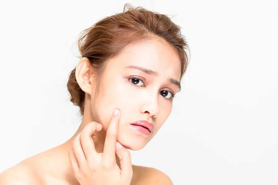LightStim Acne by Dermatique Laser and Skin, C Corp in Geneva, IL