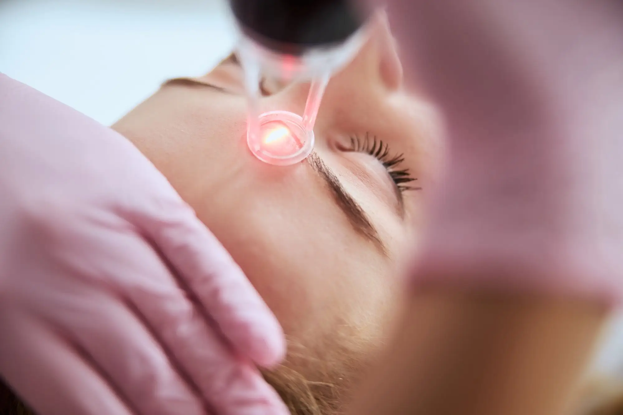 Laser Facial Treatment in Geneva IL